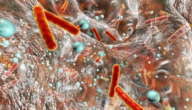 Biofouling: quelles solutions mettre en oeuvre ?