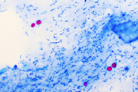 Quels outils puis-je mettre en place pour prévenir une contamination par le Cryptosporidium ?